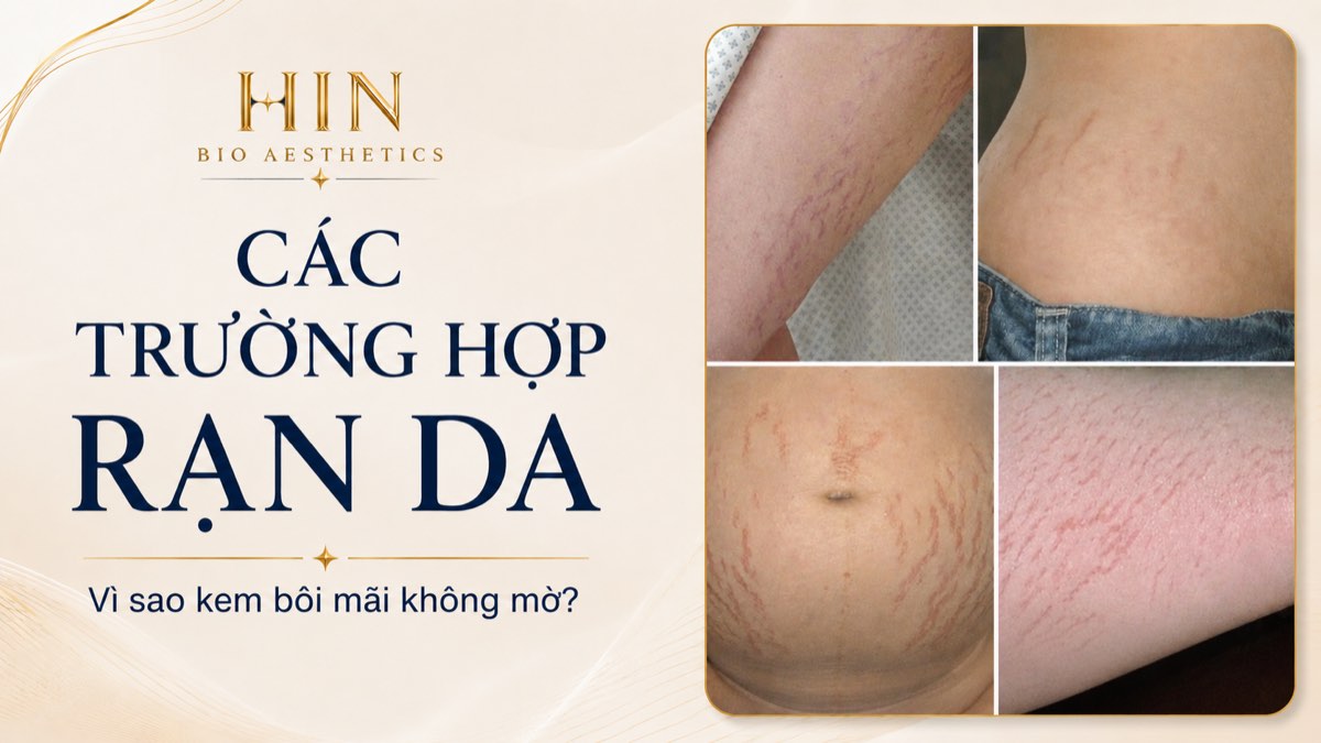 Các trường hợp rạn da thường gặp: rạn bụng sau sinh, rạn hông, rạn đùi, rạn tay — giai đoạn rạn đỏ và rạn trắng
