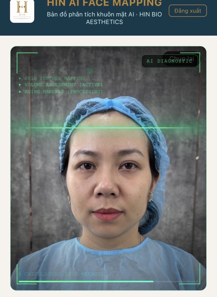 Hệ thống HIN AI Face Mapping đang quét và phân tích khuôn mặt khách hàng thực tế