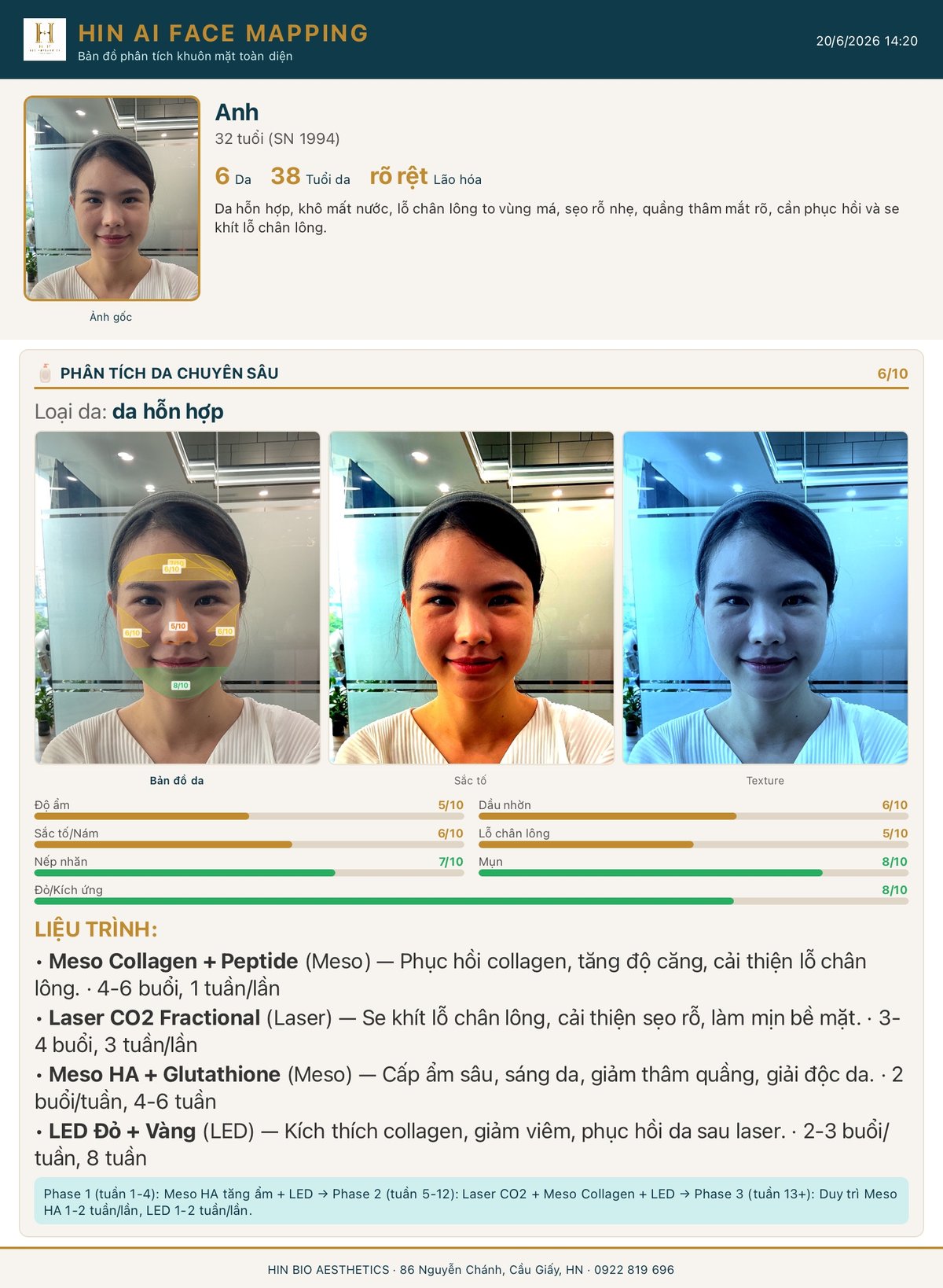 Phiếu kết quả phân tích da chuyên sâu HIN AI Face Mapping — bản đồ da, sắc tố, texture và 7 thang điểm