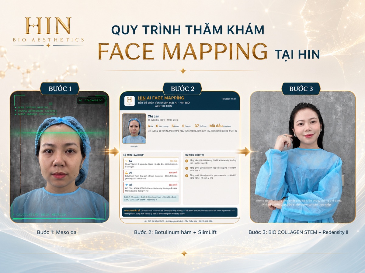 Quy trình thăm khám Face Mapping tại HIN — bước 1 quét khuôn mặt, bước 2 phiếu phân tích và lộ trình, bước 3 khách hàng sau liệu trình