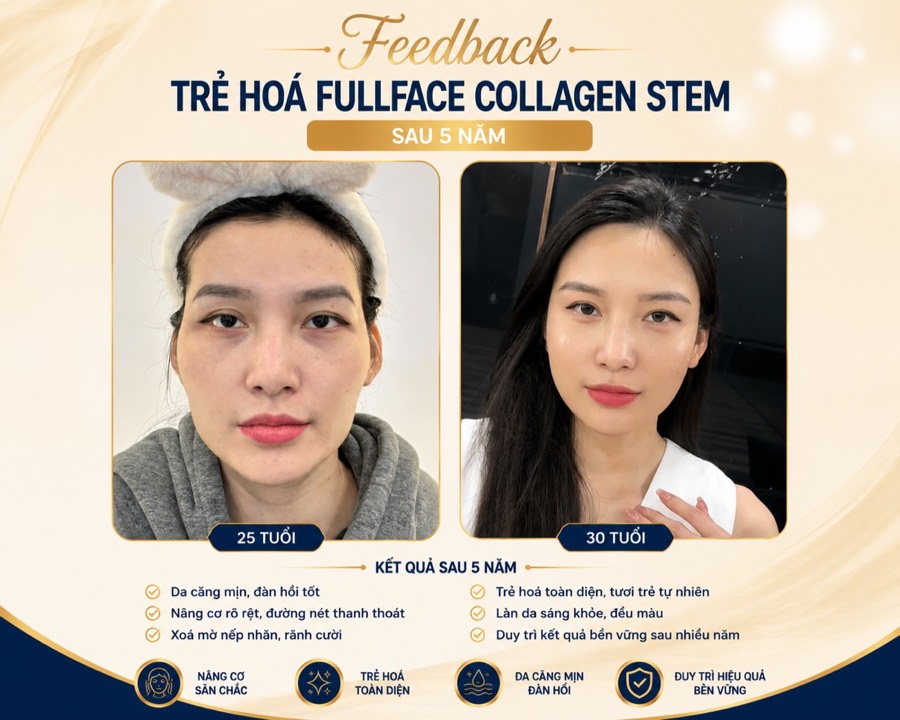 Feedback trẻ hóa fullface Collagen Stem — kết quả duy trì bền vững sau 5 năm