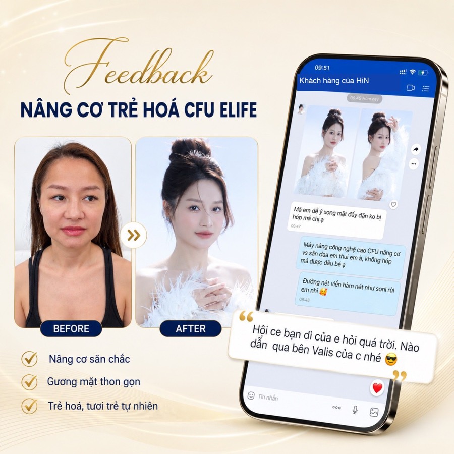 Feedback khách nâng cơ trẻ hóa CFU Èlife — tin nhắn cảm ơn thực tế