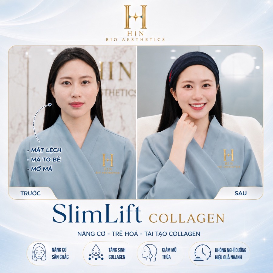 Khách hàng SlimLift Collagen trước và sau — mặt lệch, má to bè được cải thiện