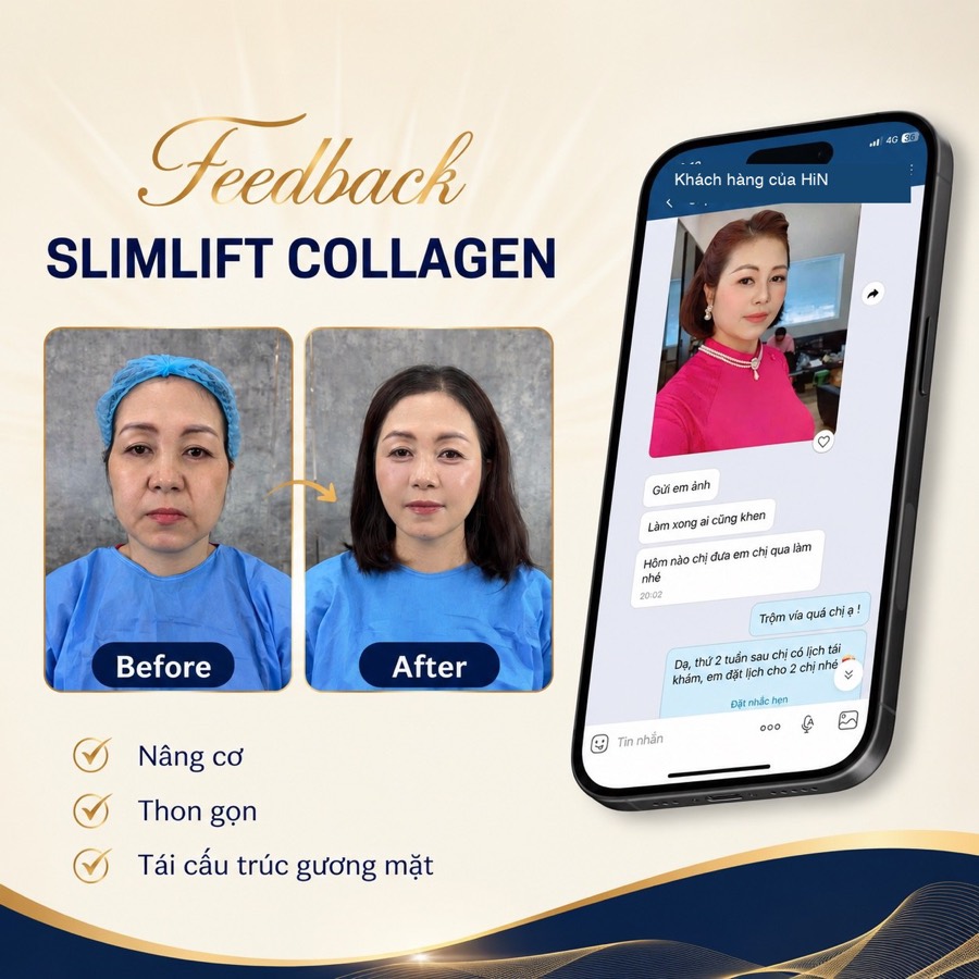 Feedback SlimLift Collagen — nâng cơ thon gọn, tin nhắn khách hàng thực tế