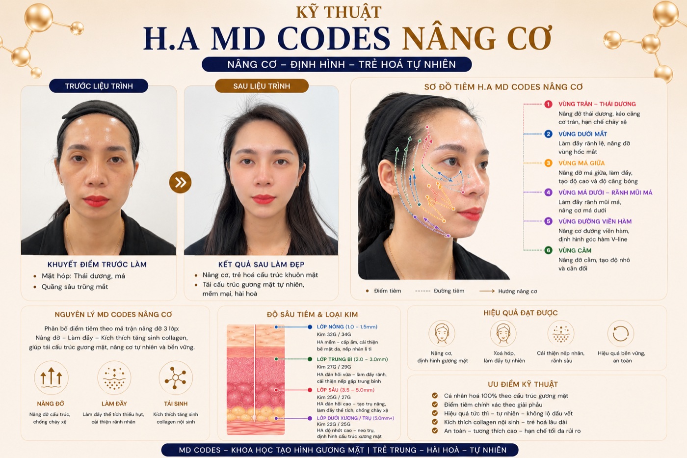 H.A MD Codes — filler chuẩn mã điểm quốc tế