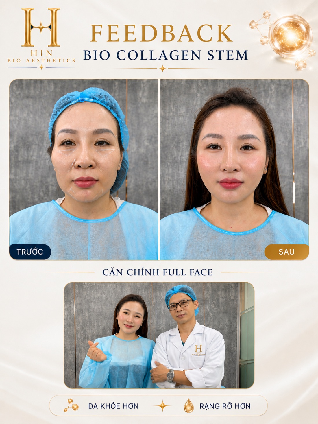 Khách hàng căn chỉnh full face bằng Bio Collagen Stem tại HIN BIO — da khỏe hơn rạng rỡ hơn, chụp cùng bác sĩ