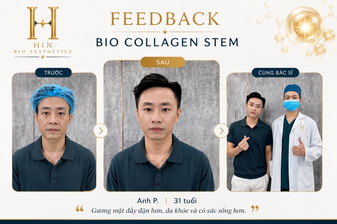 Khách nam 31 tuổi trẻ hóa bằng Bio Collagen Stem tại HIN BIO — gương mặt đầy đặn hơn, da khỏe hơn, chụp cùng bác sĩ