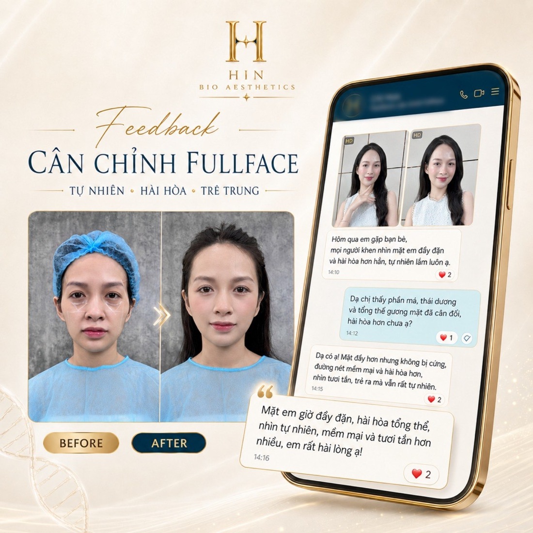Feedback khách cân chỉnh fullface tại HIN BIO — mặt đầy đặn hài hòa tự nhiên, kèm tin nhắn khách hàng thật