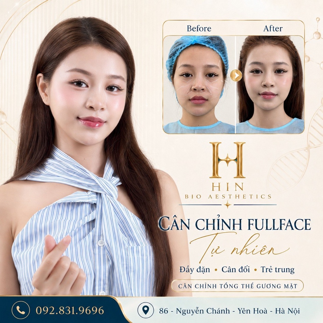 Khách hàng cân chỉnh fullface tự nhiên tại HIN BIO AESTHETICS — gương mặt đầy đặn cân đối trẻ trung, ảnh trước sau