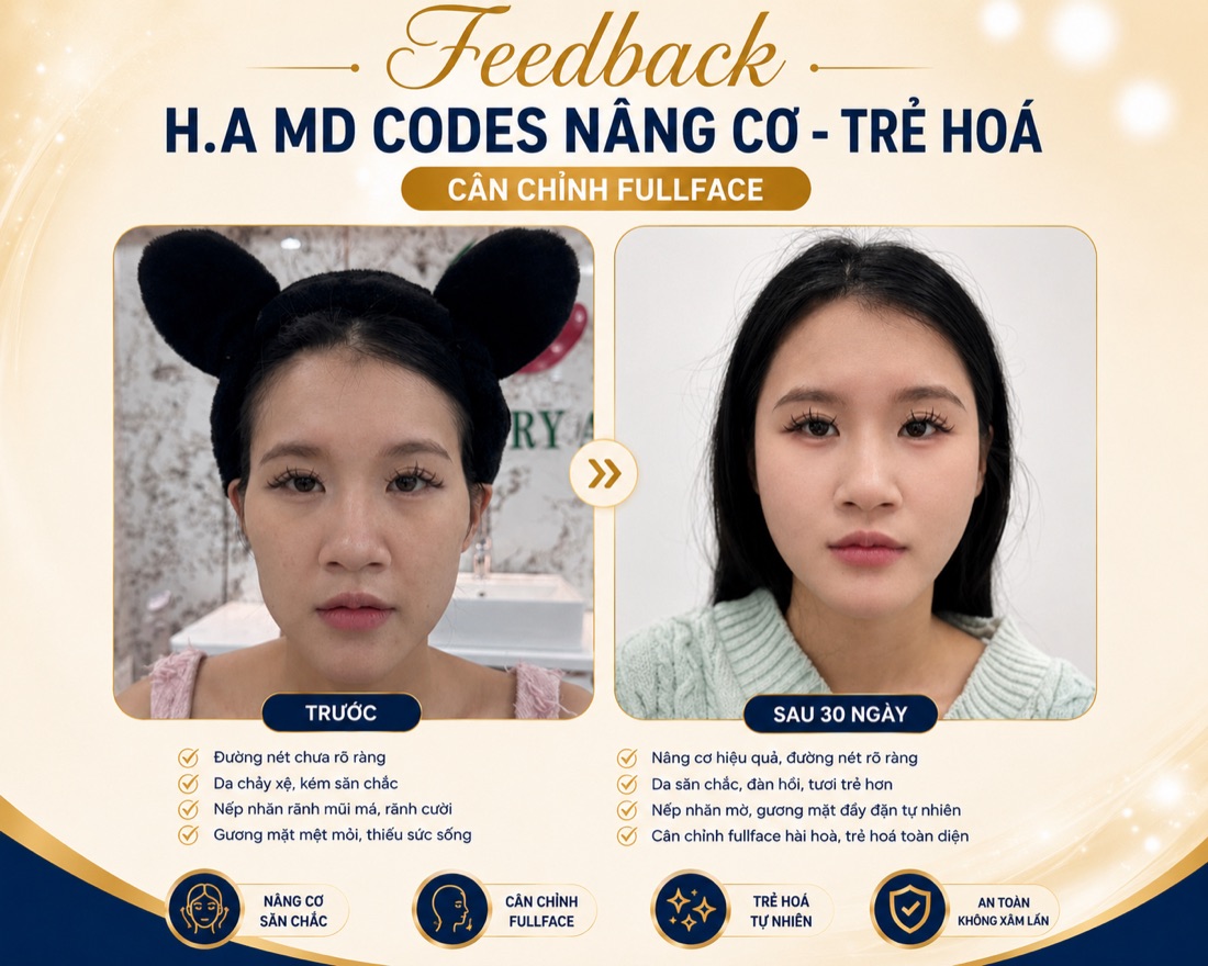 Khách hàng cân chỉnh fullface bằng H.A MD Codes tại HIN BIO — trước và sau 30 ngày, đường nét rõ ràng tự nhiên