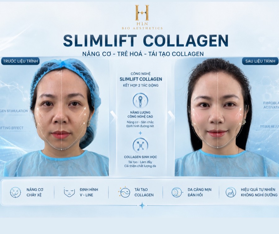 Kết quả SlimLift Collagen — nâng cơ, định hình V-line, tái tạo collagen trước và sau